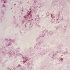 BS12082  4.1.1
